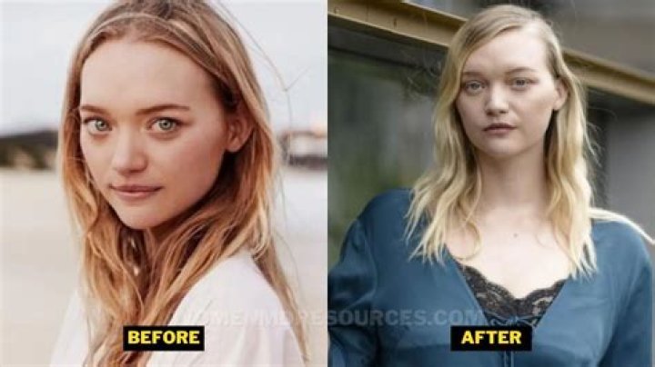 Is Gemma Ward Weight Gain Linked To Pregnancy | Before And After Photos