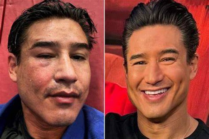 Mario Lopez: Is He Sick? What Took Place: Illness And Health In 2023