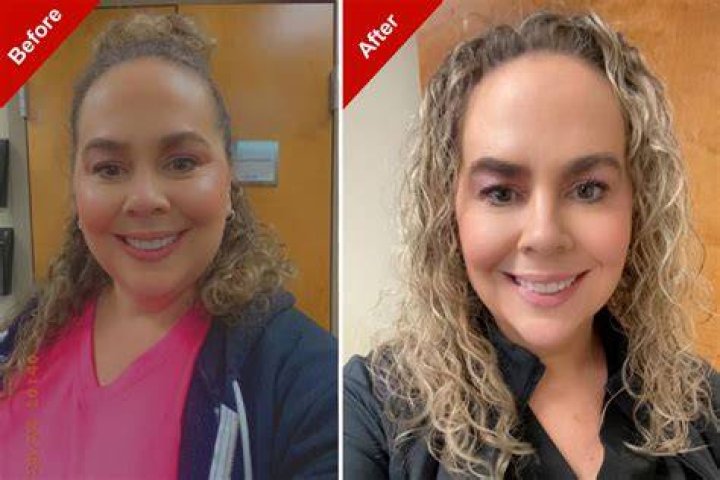 Omid Scobie Weight Loss Journey | Before And After Photo